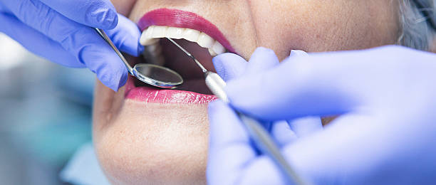 Best Dental Abscess Treatment in Cambridge, NE